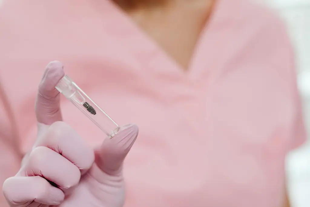 dental implant price